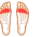 metatarsalgia-01