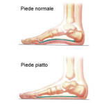 piede_piatto-01